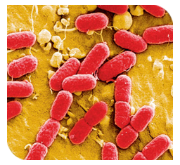 Avian pathogenic escherichia coli